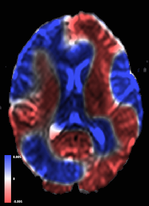 301 - rate of strain tensor display