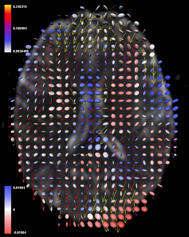 301 - rate of strain tensor display