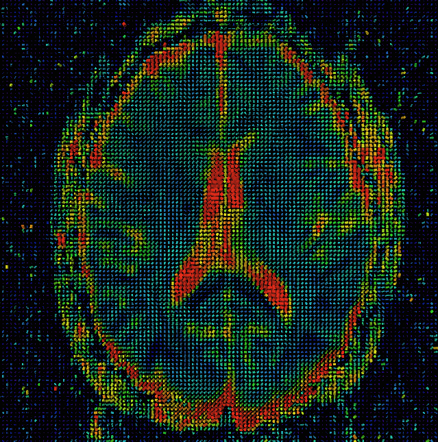 301 - tensor display